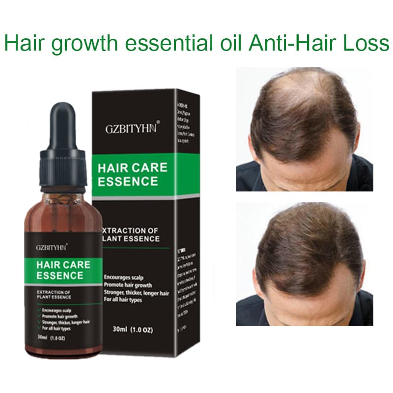跨境 头发精油 hair growth oil